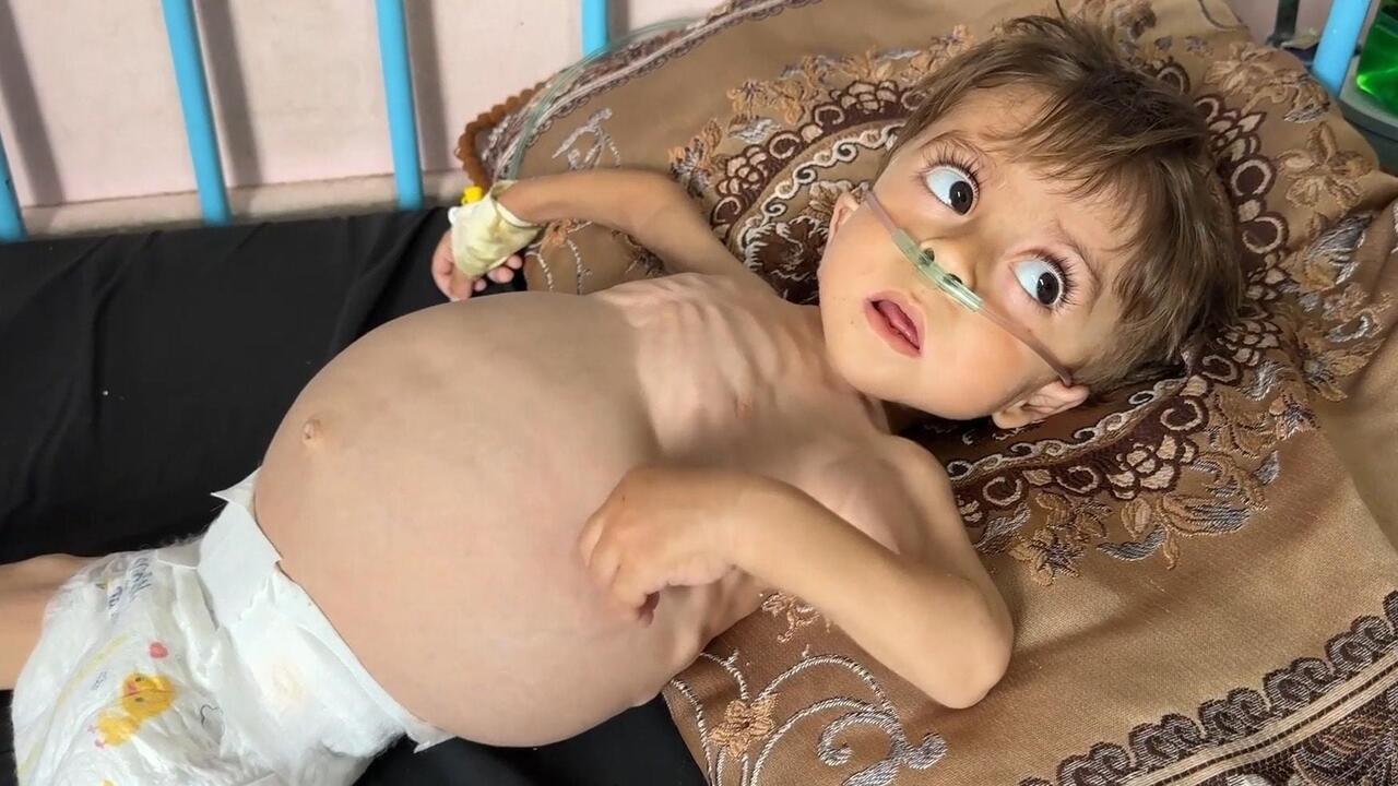 'His health deteriorates every day' - Three-year-old Gazan boy with rare kidney disease