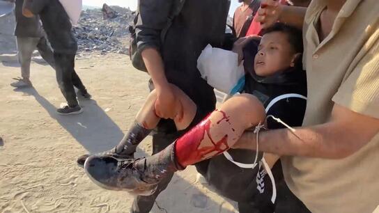 'Risking life for mouthful of bread!' - Crowds injured in rush for food aid in northern Gaza *DISTRESSING* 